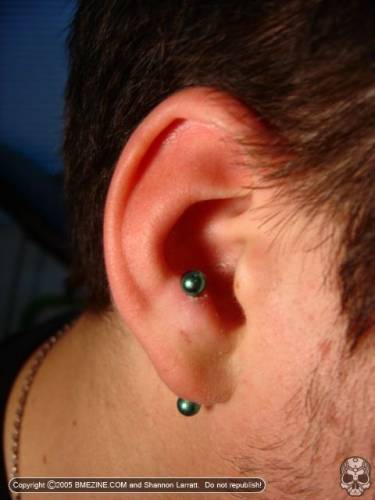 lobes verticale